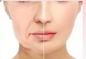 جهاز بتقنية ذكيه بيساعدك على رفع وشد الوجه والذقن بالضوء والمساج لتحصلي عالشكل يلي بتتمنيه